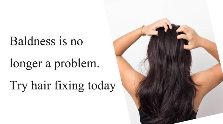 Baldness is no longer a problem. Try hair fixing today