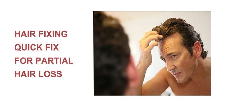 Hair fixing quick fix for partial hair loss